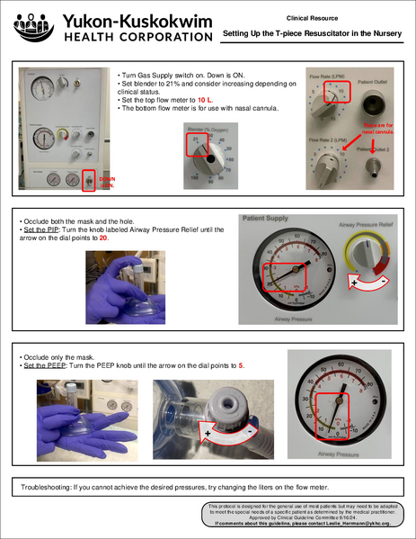 File:NeoPuff set up.pdf