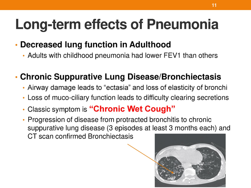 File:Bronchiectasis.pdf