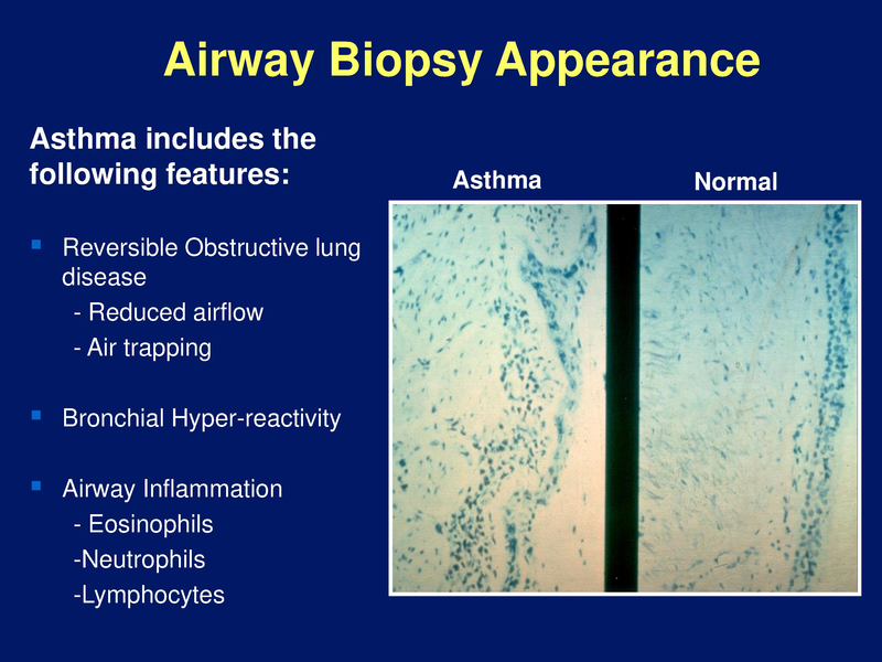 File:Pediatric Asthma - 7-9-2019.pdf