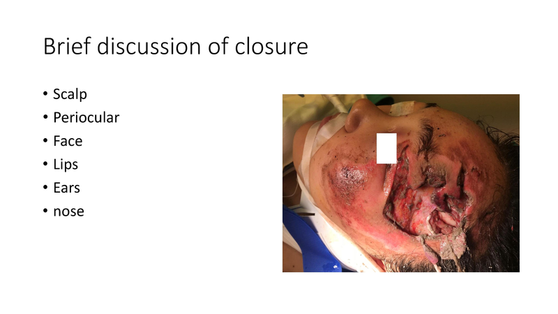 File:Facial Trauma - 4-4-2019.pdf