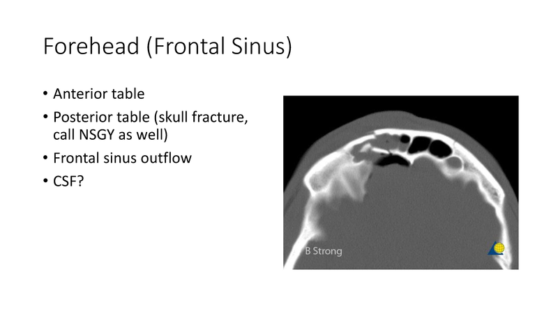 File:Facial Trauma - 4-4-2019.pdf