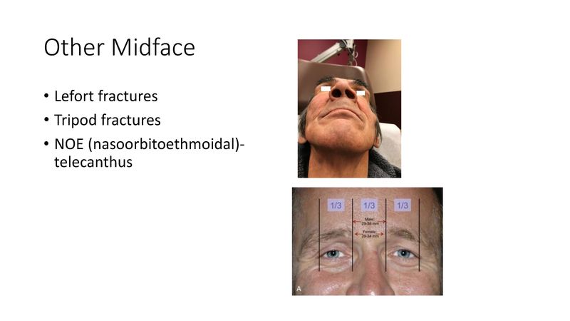 File:Facial Trauma - 4-4-2019.pdf