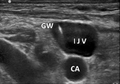 Thumbnail for version as of 17:22, 7 October 2020