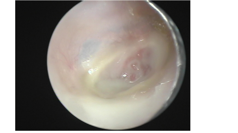 File:The draining ear.pdf