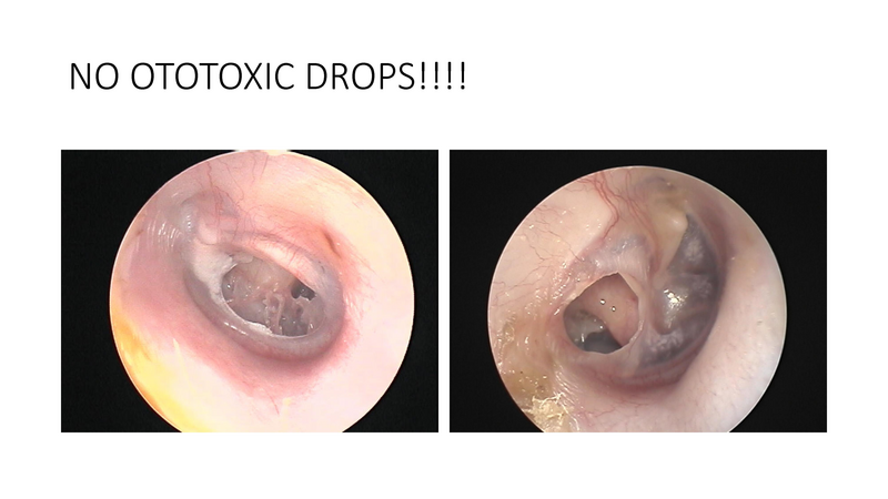 File:The draining ear.pdf