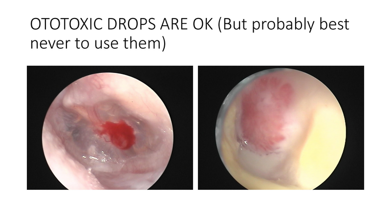 File:The draining ear.pdf