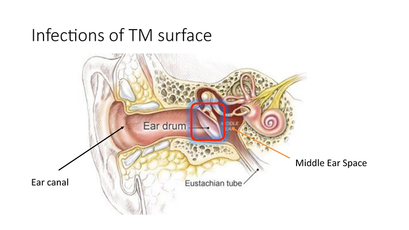 File:The draining ear.pdf