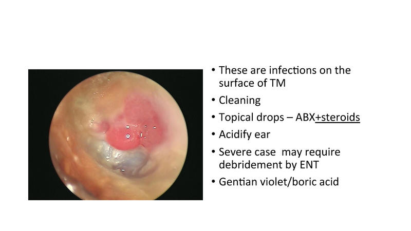 File:The draining ear.pdf