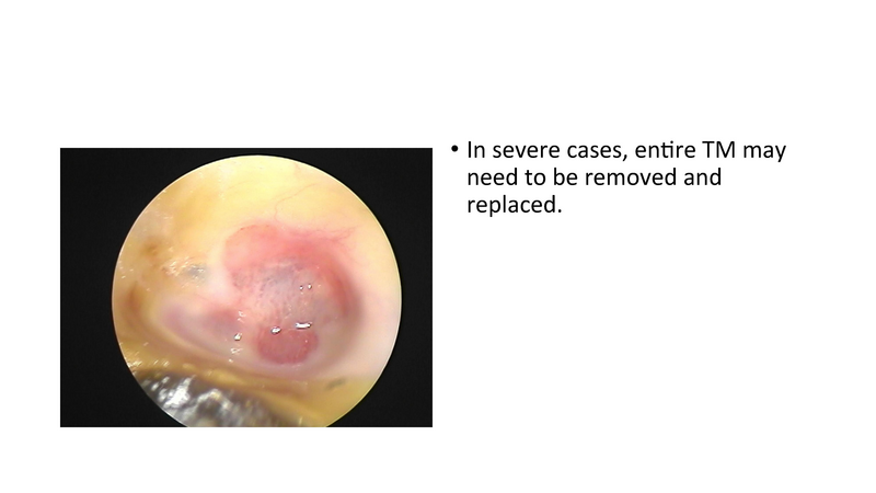 File:The draining ear.pdf