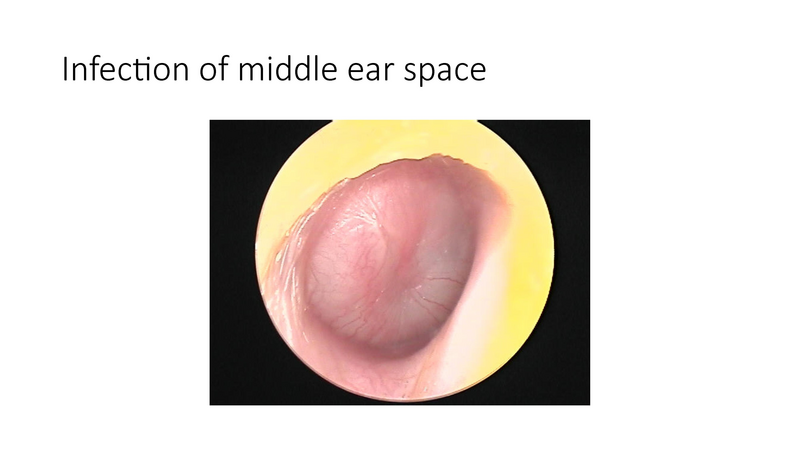File:The draining ear.pdf