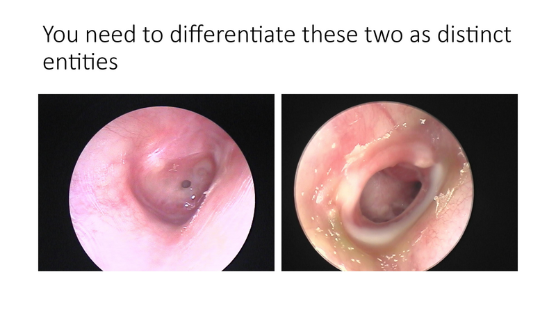 File:The draining ear.pdf