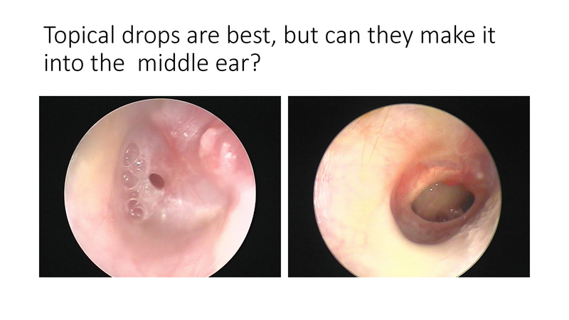 File:The draining ear.pdf