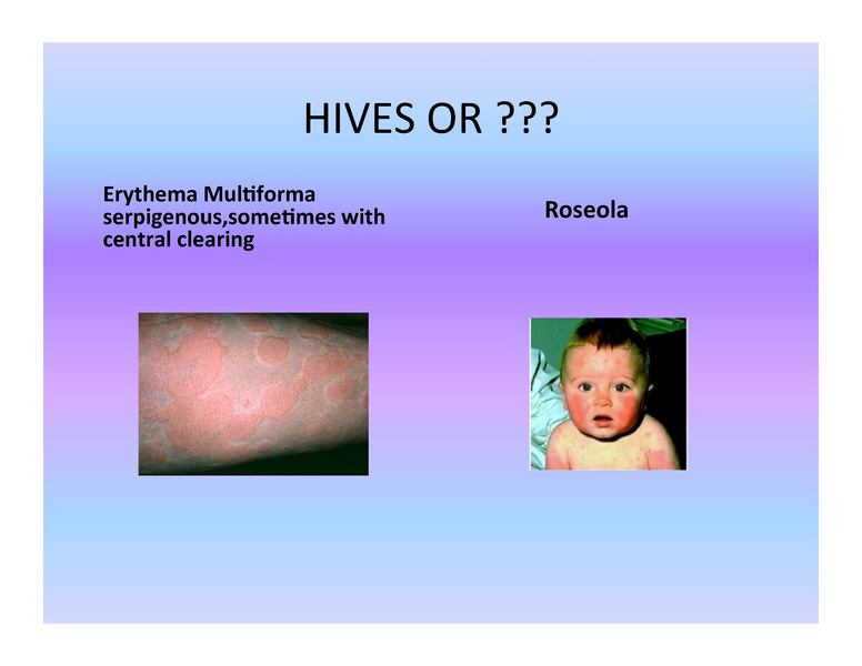 File:Stamping Out Amoxicillin Allergy.pdf