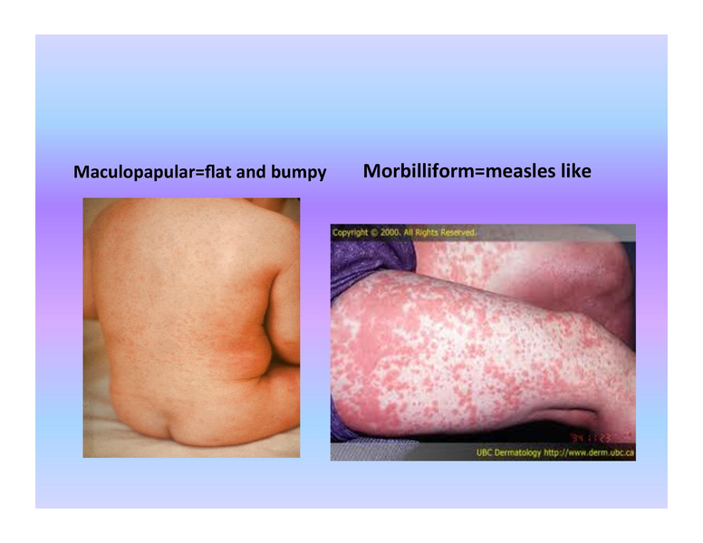 File:Stamping Out Amoxicillin Allergy.pdf