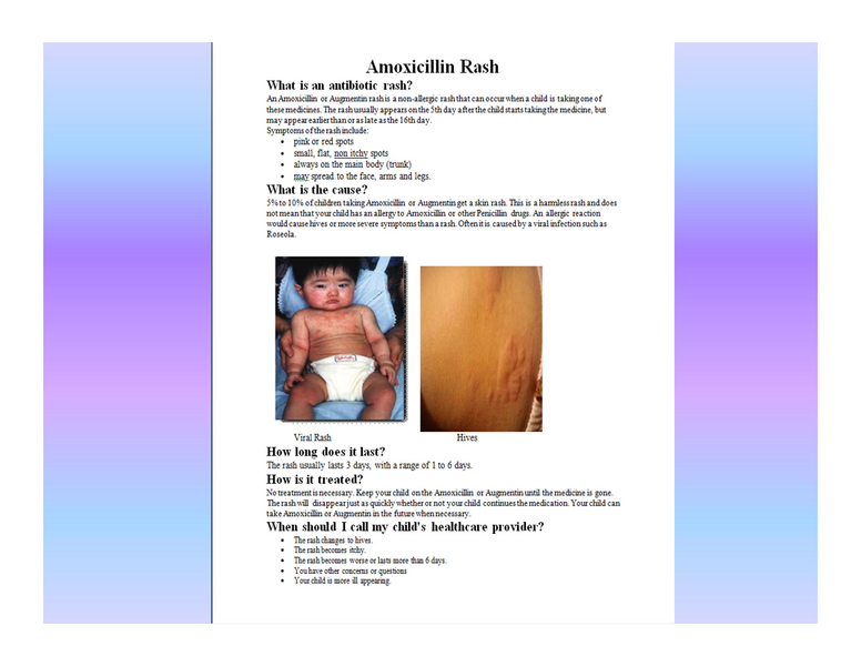 File:Stamping Out Amoxicillin Allergy.pdf
