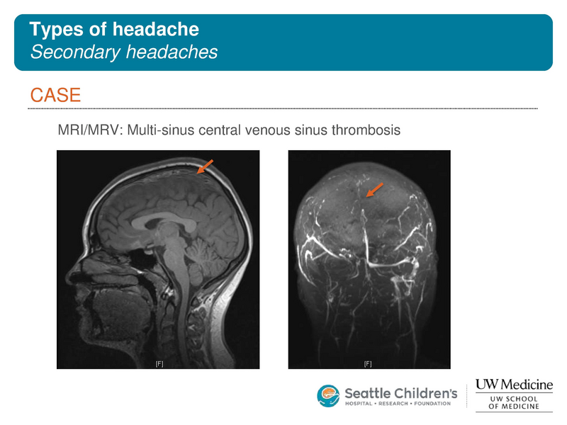 File:Pediatric headache.pdf