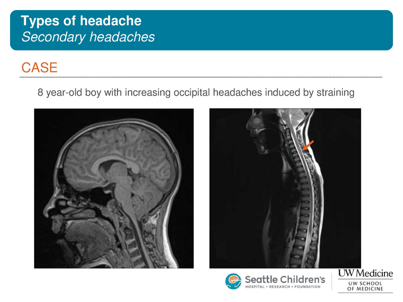 File:Pediatric headache.pdf