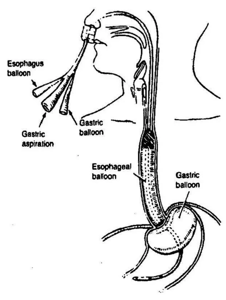 File:Blakemore tube CR Bard.png