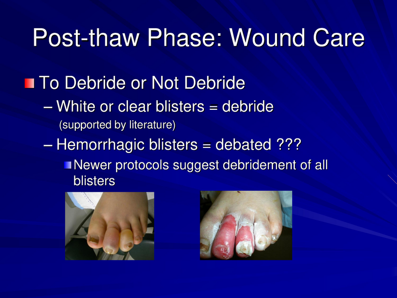 File:Frostbite-Presentation.pdf