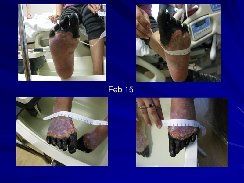 File:Frostbite-Presentation.pdf