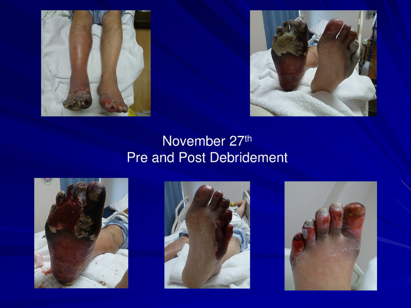 File:Frostbite-Presentation.pdf