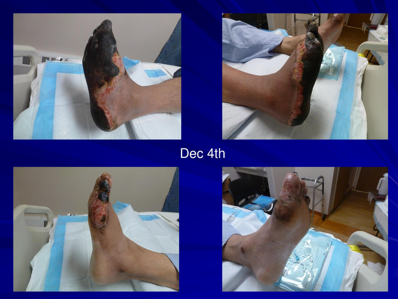 File:Frostbite-Presentation.pdf