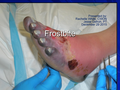Thumbnail for version as of 20:48, 31 May 2016