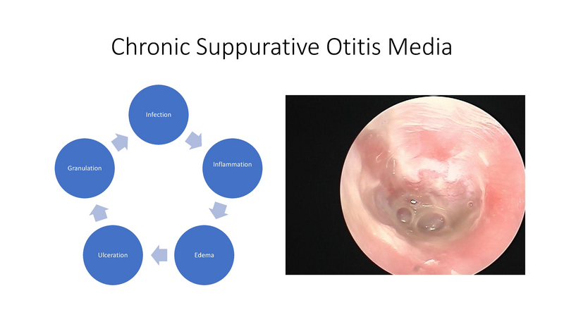 File:Otitis Media -8-13-19.pdf