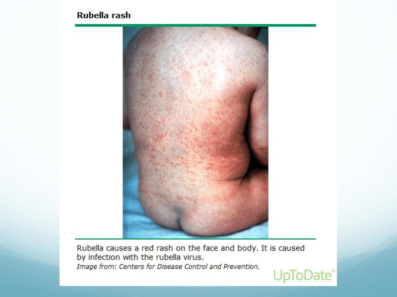 File:Childhood Rashes.pdf