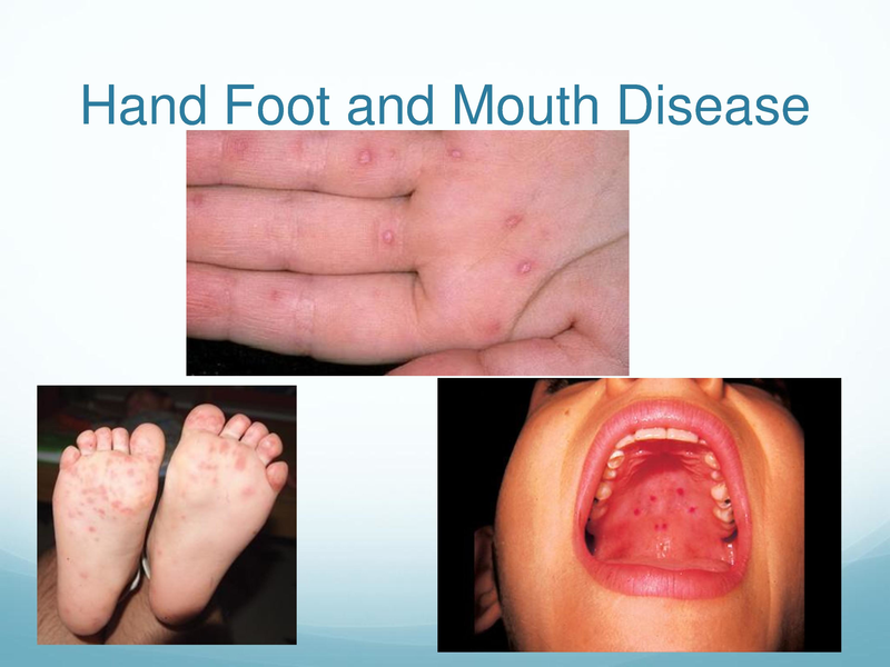 File:Childhood Rashes.pdf