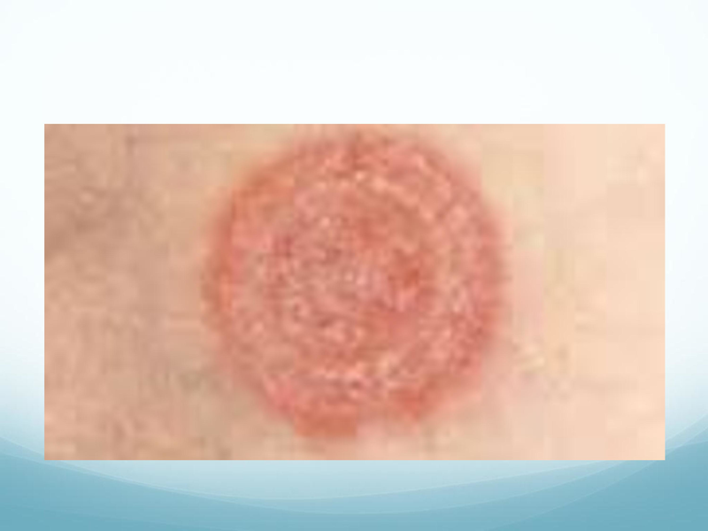 File:Childhood Rashes.pdf
