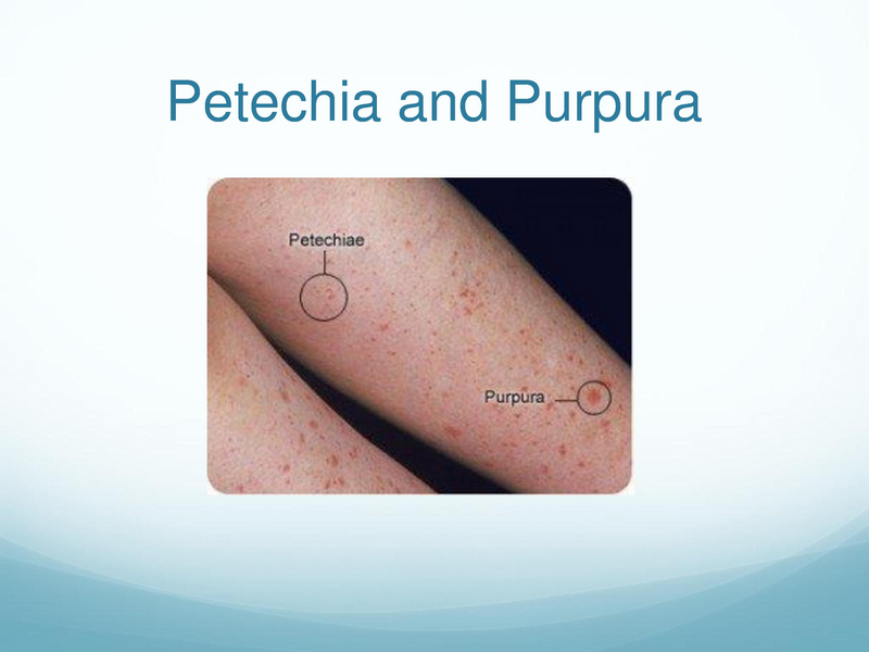 File:Childhood Rashes.pdf