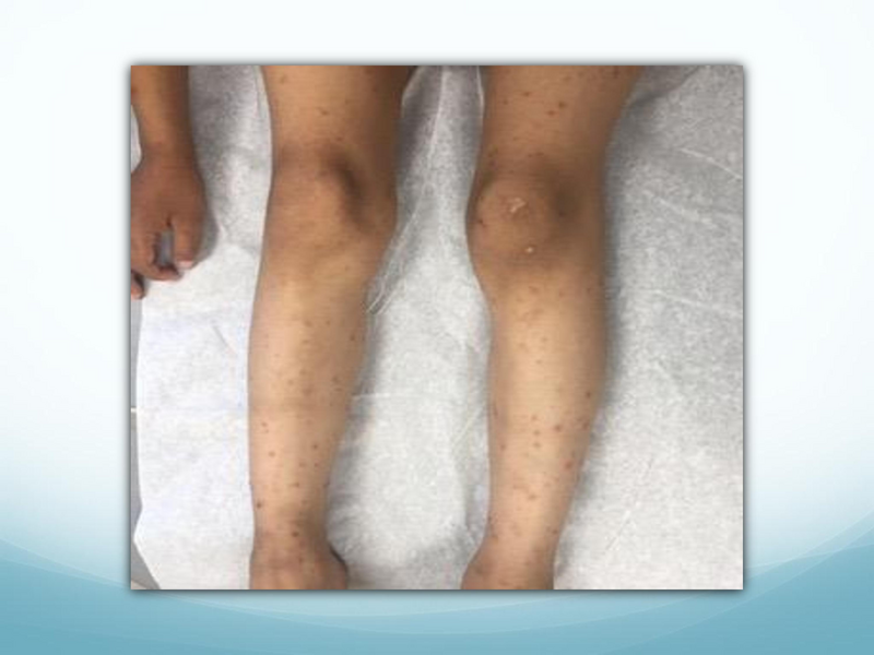 File:Childhood Rashes.pdf
