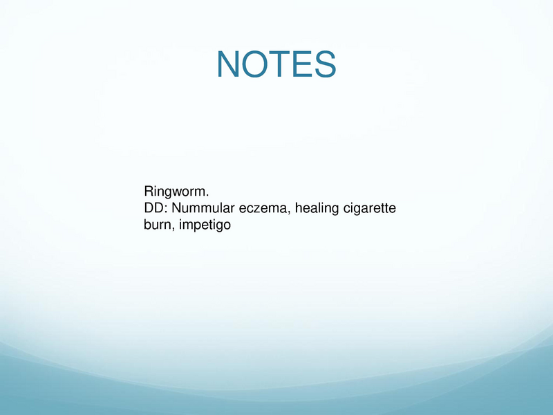 File:Childhood Rashes.pdf