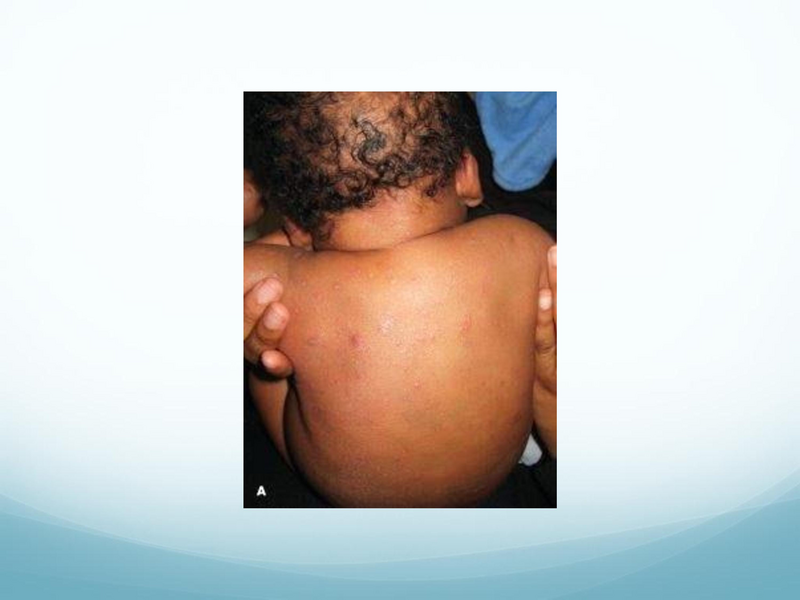 File:Childhood Rashes.pdf