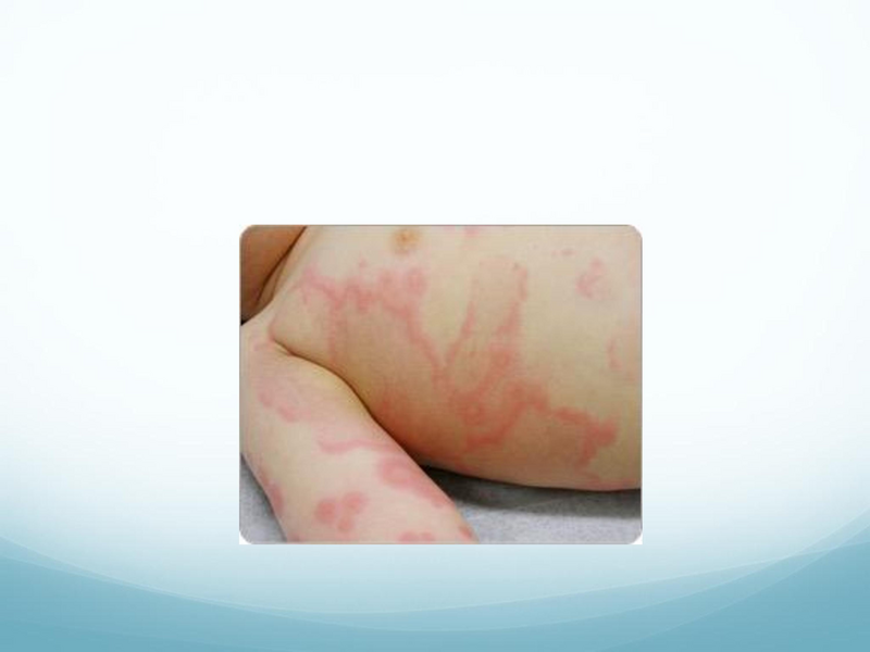 File:Childhood Rashes.pdf