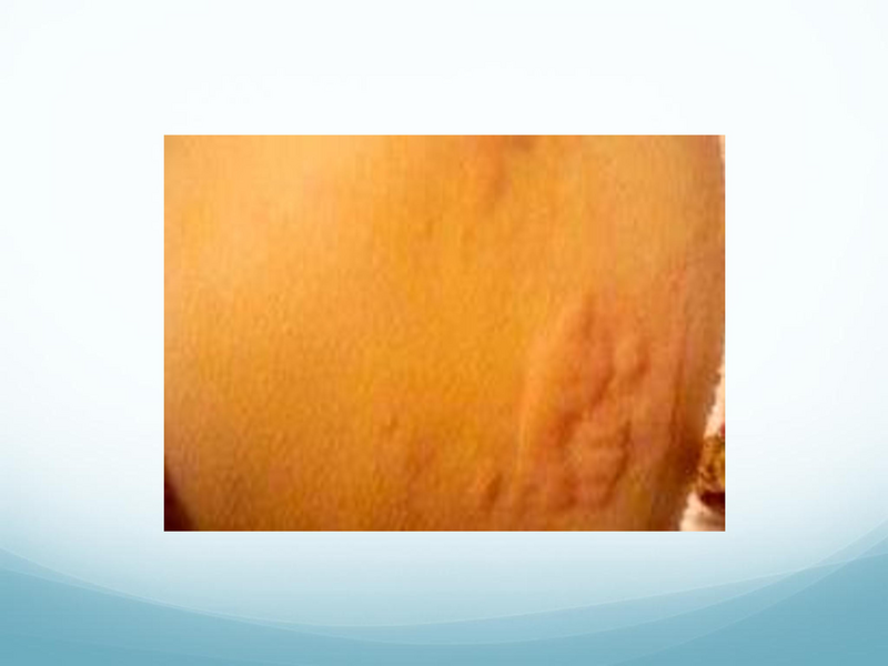 File:Childhood Rashes.pdf