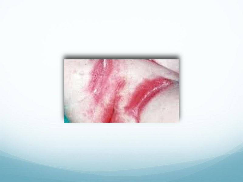 File:Childhood Rashes.pdf