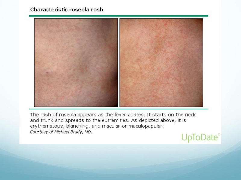 File:Childhood Rashes.pdf