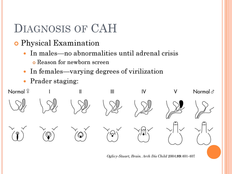 File:Congenital Adrenal Hyperplasia.pdf