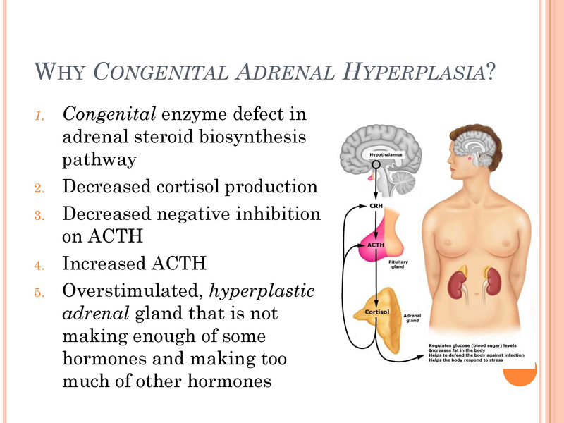 File:Congenital Adrenal Hyperplasia.pdf