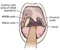 Thumbnail for version as of 18:26, 7 October 2020