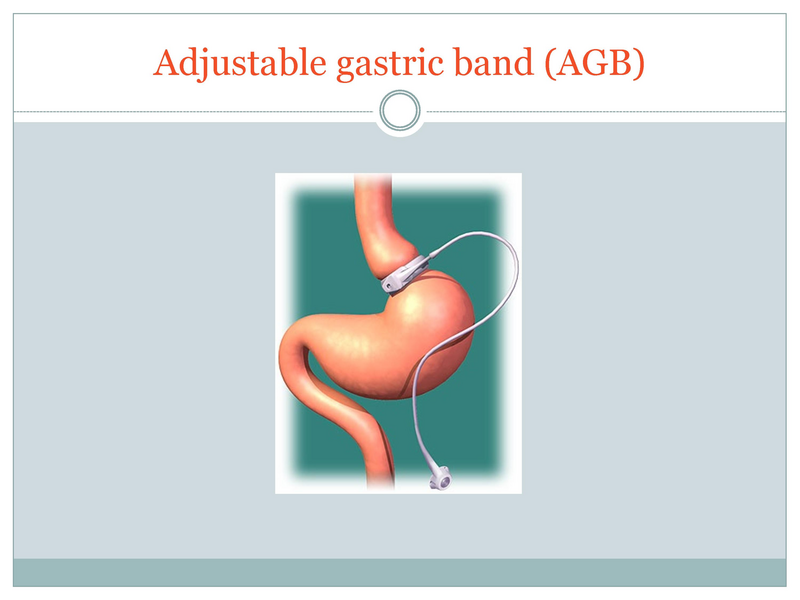 File:Childhood Obesity.pdf