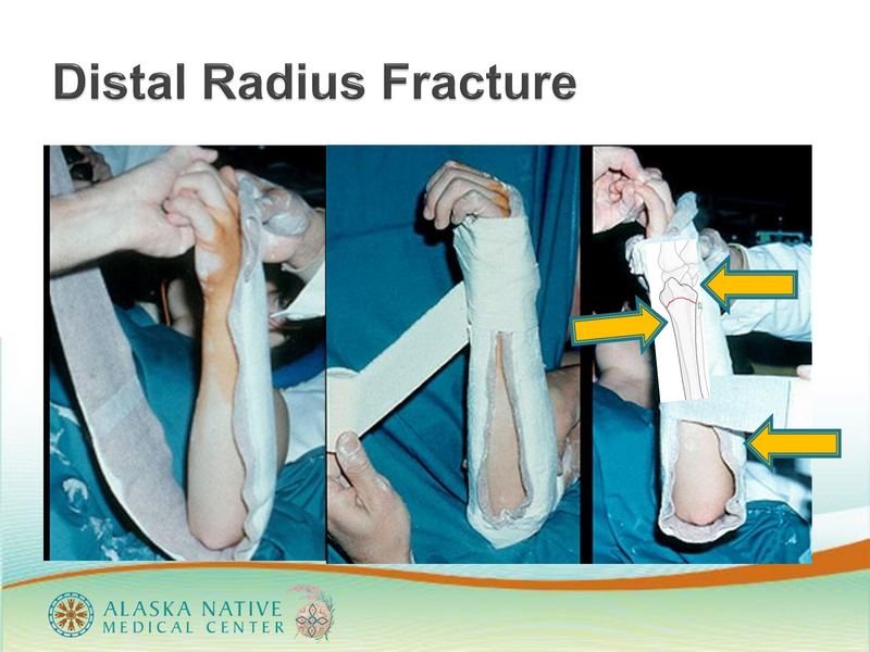 File:ANMC Hand Ortho - 1-30-2019.pdf