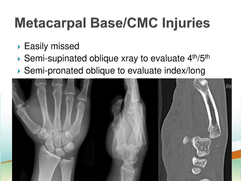 File:ANMC Hand Ortho - 1-30-2019.pdf