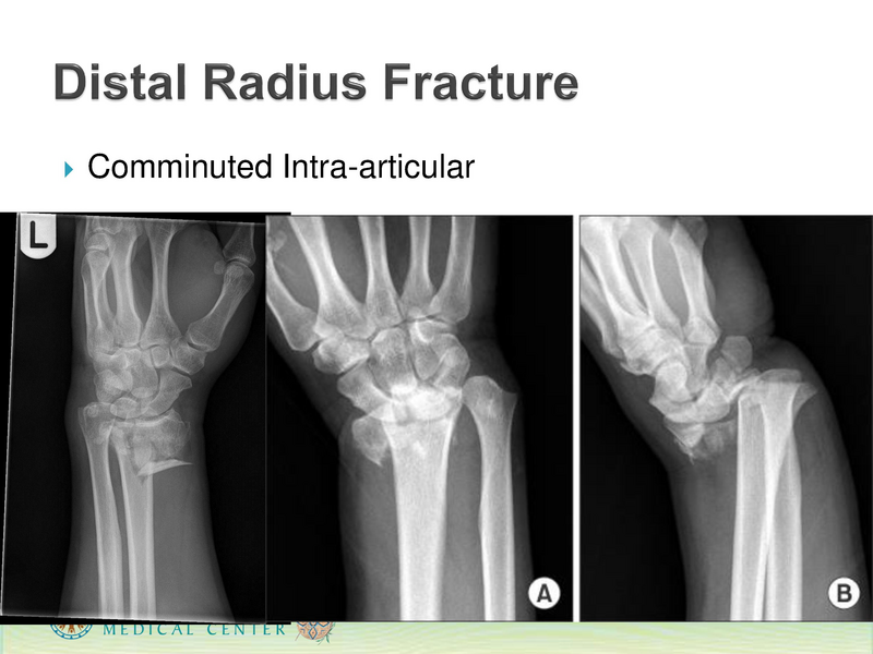 File:ANMC Hand Ortho - 1-30-2019.pdf