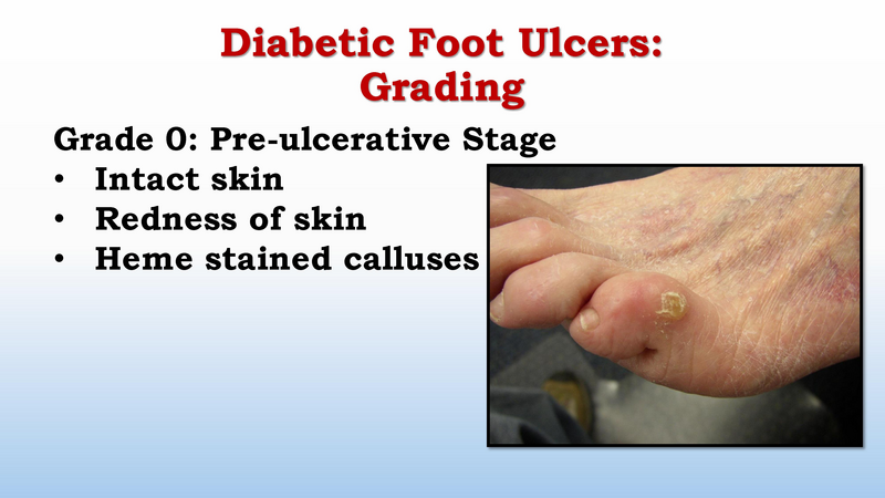 File:Diabetic Foot Complications 8.2017.pdf