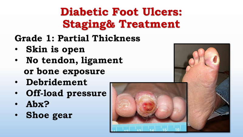 File:Diabetic Foot Complications 8.2017.pdf