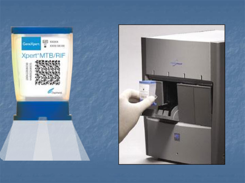 File:Xpert rapid MTB - 5-22-19.pdf