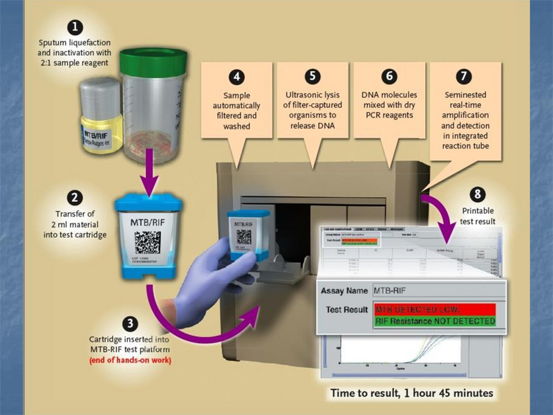File:Xpert rapid MTB - 5-22-19.pdf